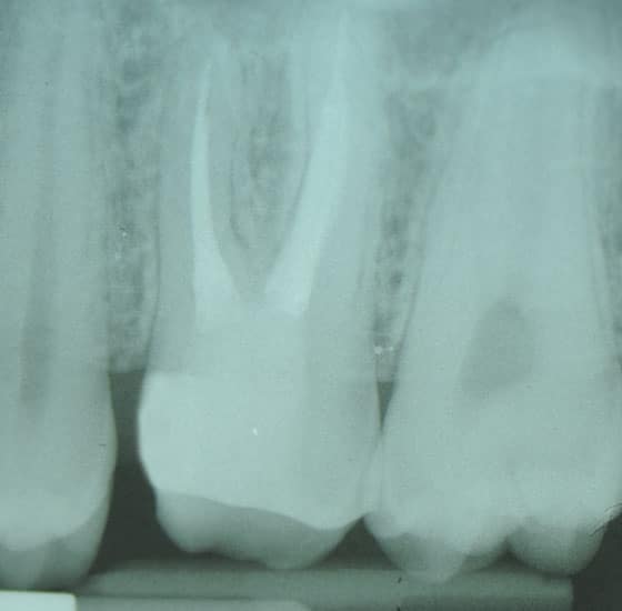 dente-vitale-2
